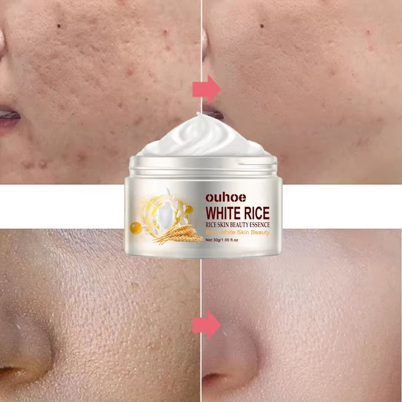 Rice Anti-Wrinkle Facial Cream Acne Melasma Treatment Pigmentation Whitening Face Lifting Beauty Moisturizer Korean Cosmetics30G