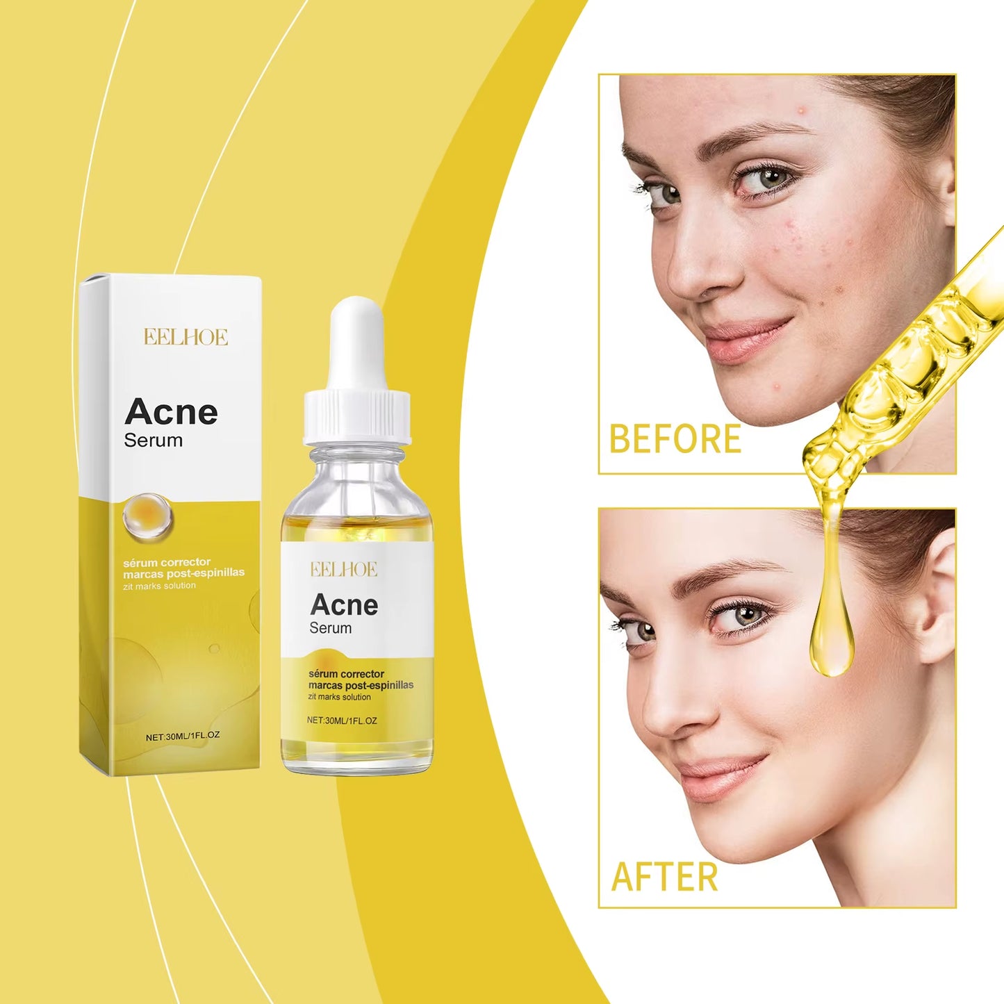 New Products Face Essence Repair Acne Skin Acne Closure Gentle Cleansing Face Skin Facial Korean Skin Care