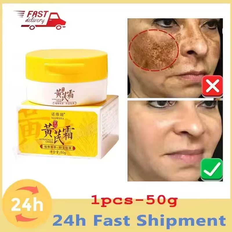 Effective Whitening Freckles Face Cream Remove Melasma Dark Spots Fade Pigmentation Acne Scars Moisturizing Brighten Beauty Care